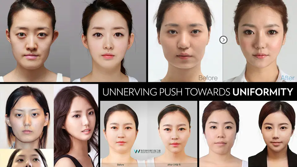 plastic surgery in Korea